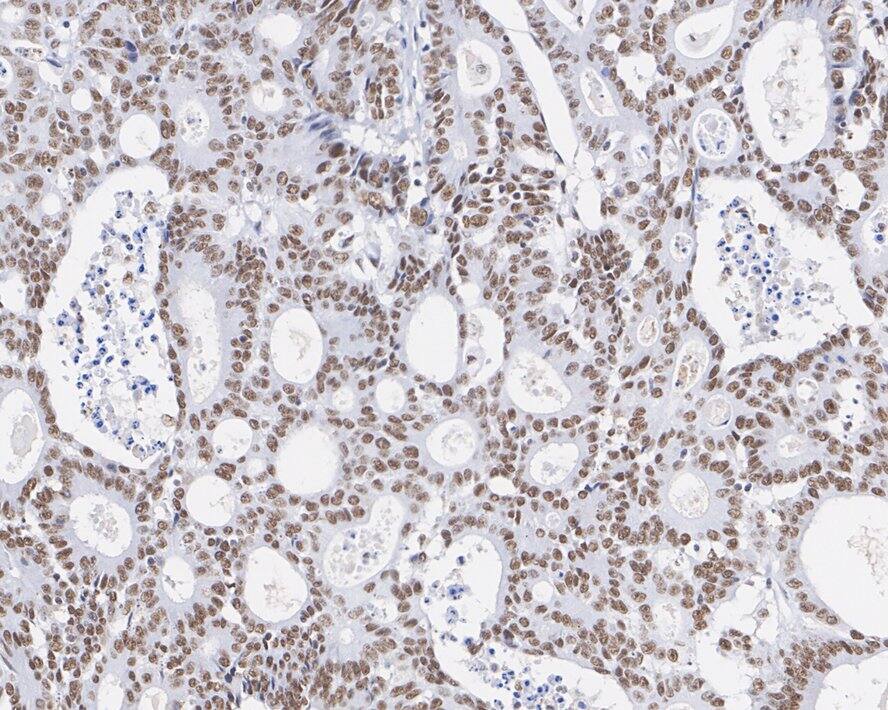 DNA-PKcs Antibody (2-B3-R)