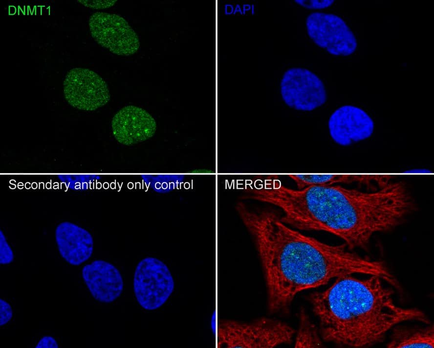 DNMT1 Antibody (A3A8-R)