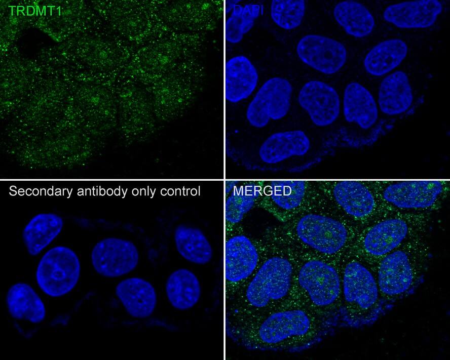 Dnmt2 Antibody (PSH03-43)