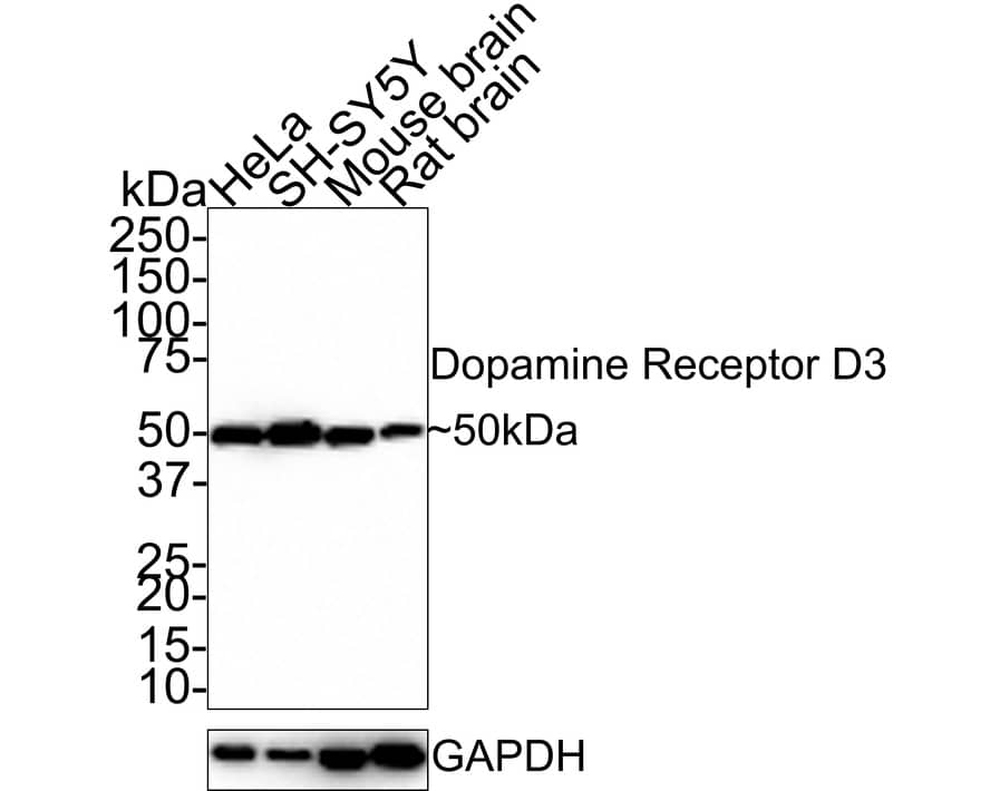 Dopamine D3R/DRD3 Antibody (JE33-33)