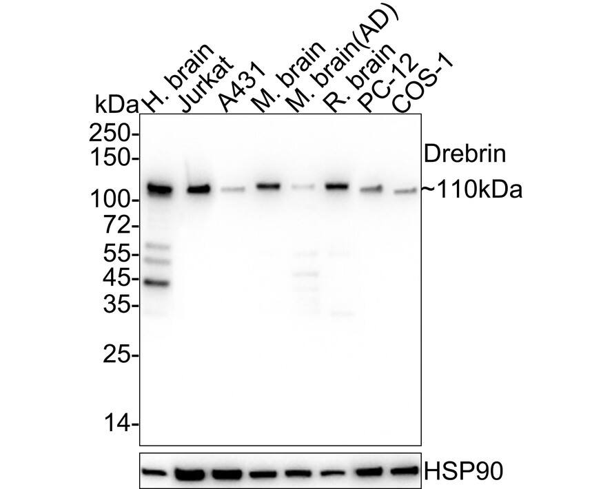 Drebrin 1 Antibody (JE30-20)