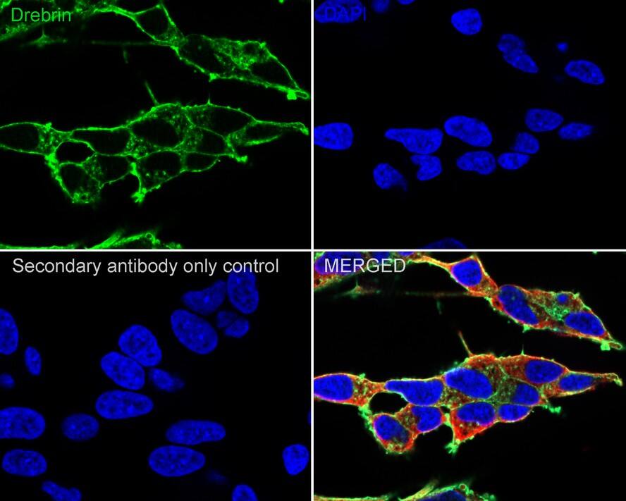 Drebrin 1 Antibody (JE30-20)