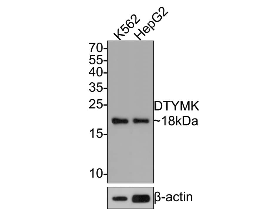 DTYMK Antibody (JE64-08)