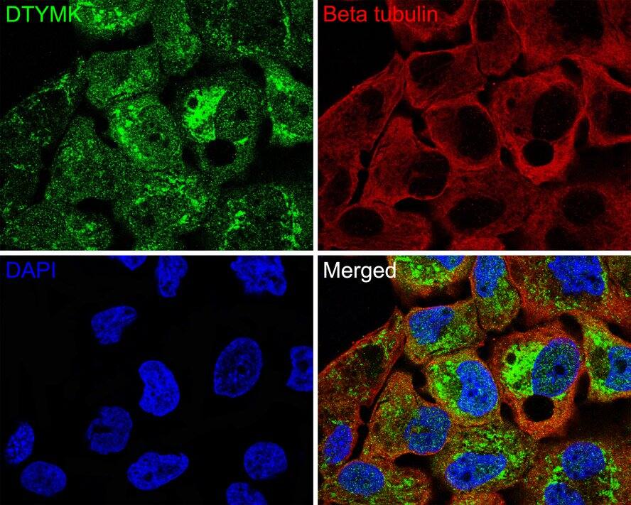 DTYMK Antibody (JE64-08)