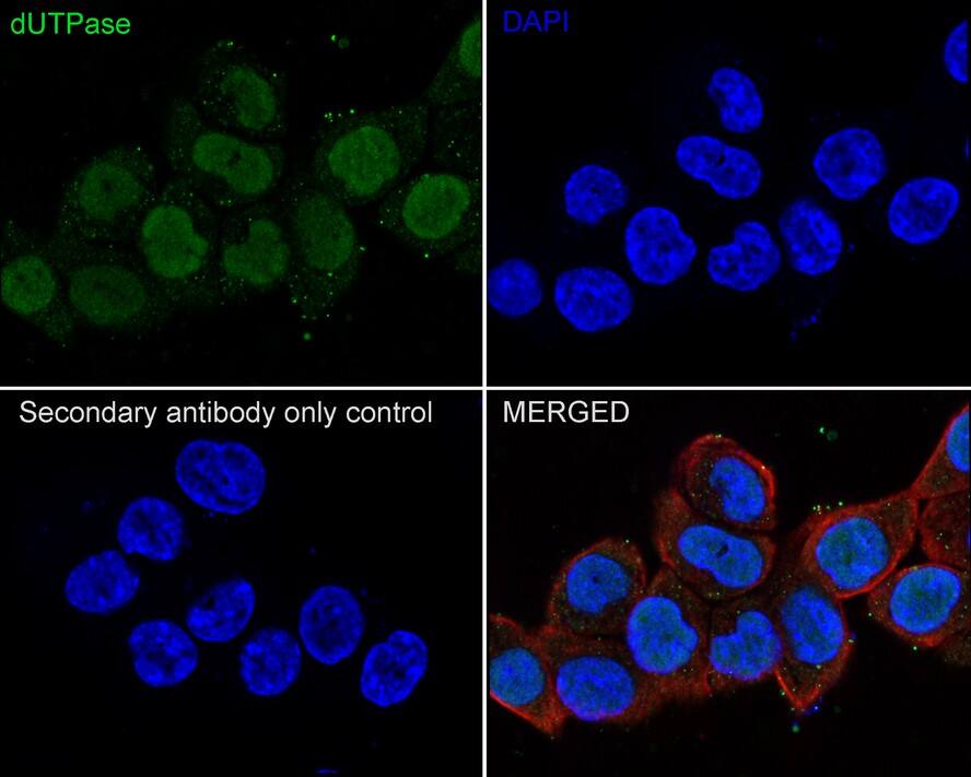 dUTPase Antibody (JE66-11)