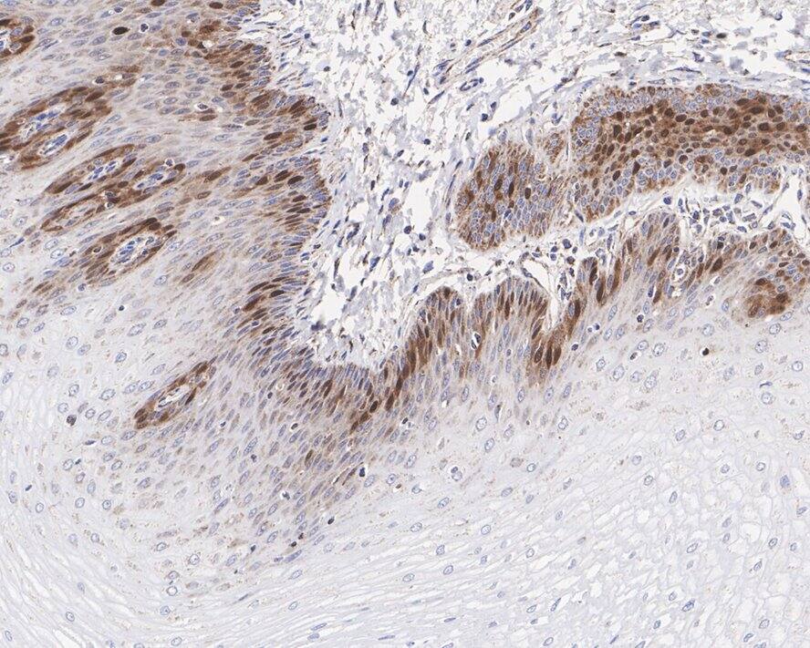 dUTPase Antibody (JE66-11)