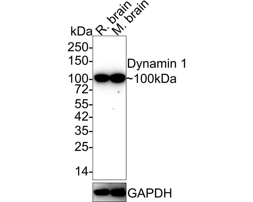 Dynamin Antibody (A1B1-R) Western Blot: Dynamin Antibody (A1B1-R) [NBP3-32282]