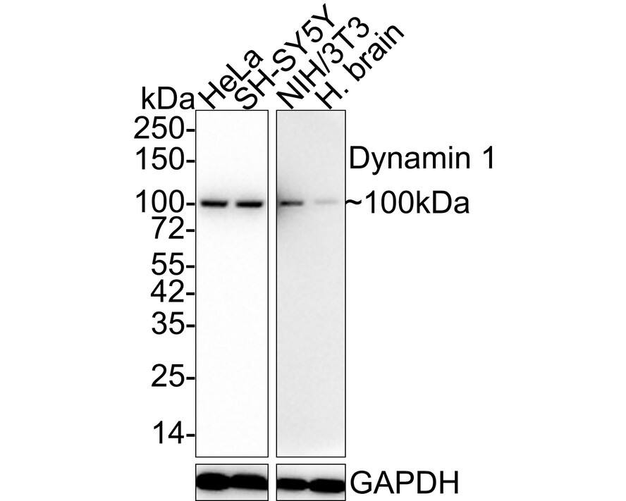 Dynamin Antibody (A1B2-R) Western Blot: Dynamin Antibody (A1B2-R) [NBP3-32283]