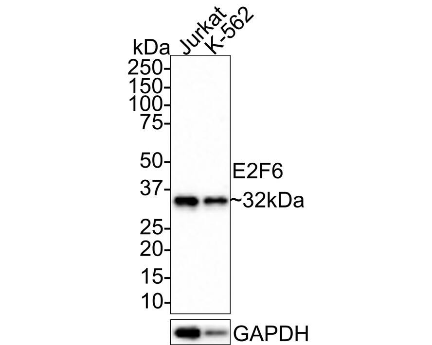 E2F6 Antibody (JE33-69)