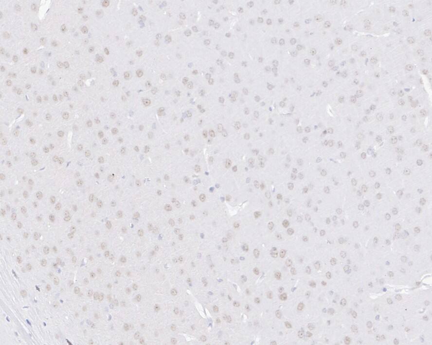 E2F6 Antibody (JE33-69)