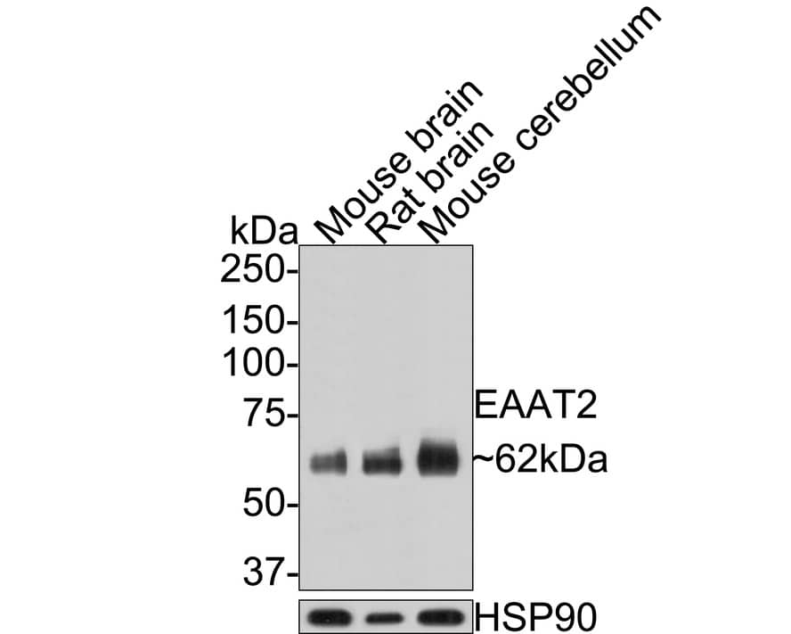 EAAT2/GLT1 Antibody (PS01-62)