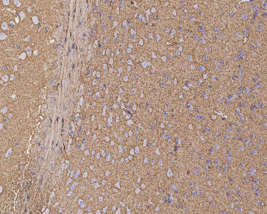 EAAT2/GLT1 Antibody (PS01-62)