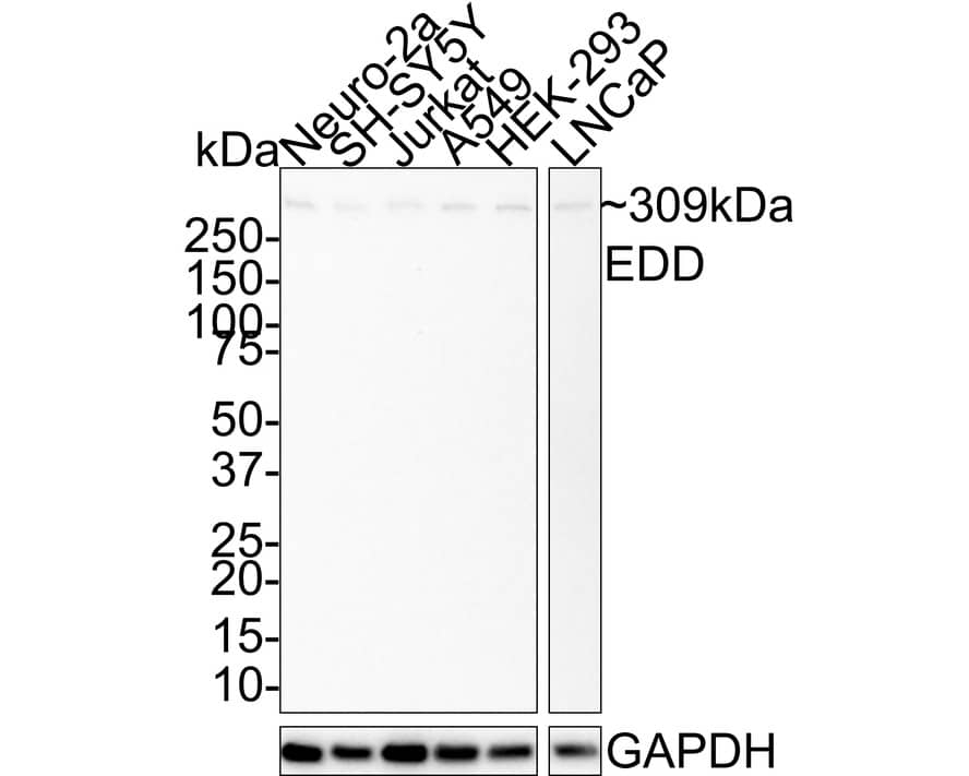 UBR5/EDD Antibody (JE38-53)