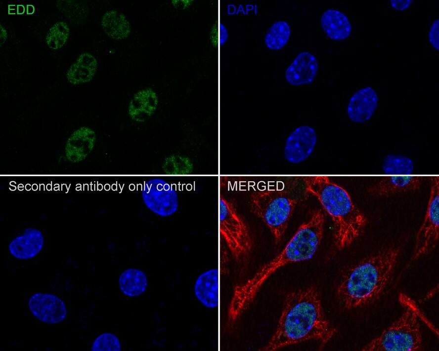 UBR5/EDD Antibody (JE38-53)