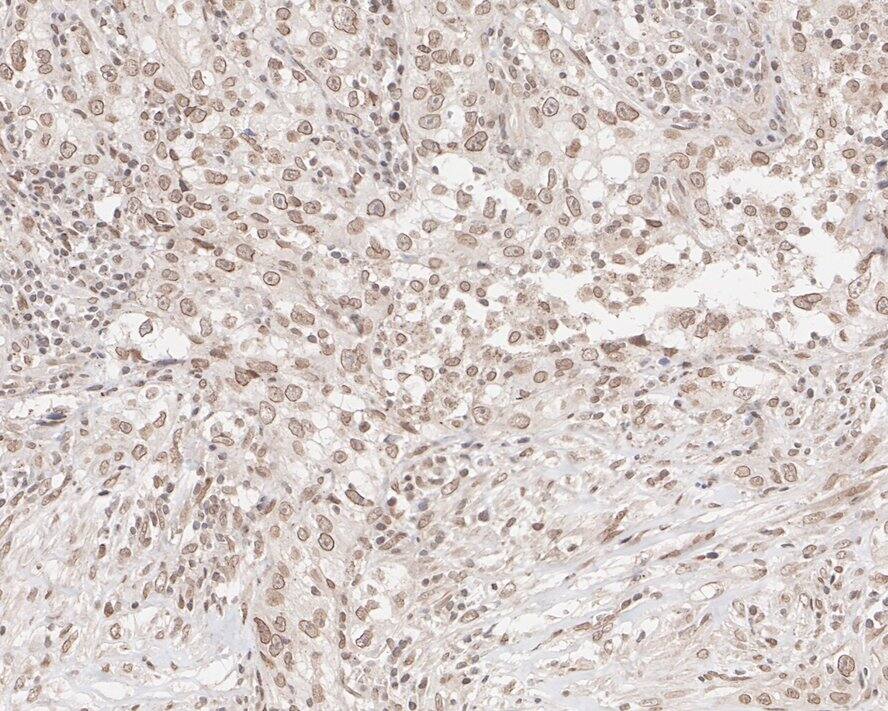 UBR5/EDD Antibody (JE38-53)