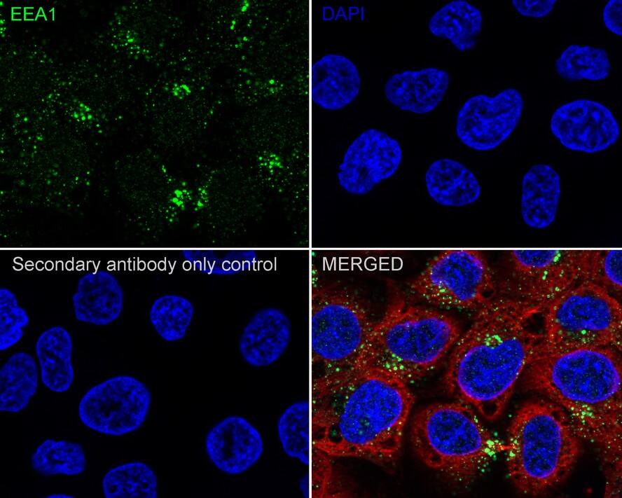 EEA1 Antibody (JE59-34)