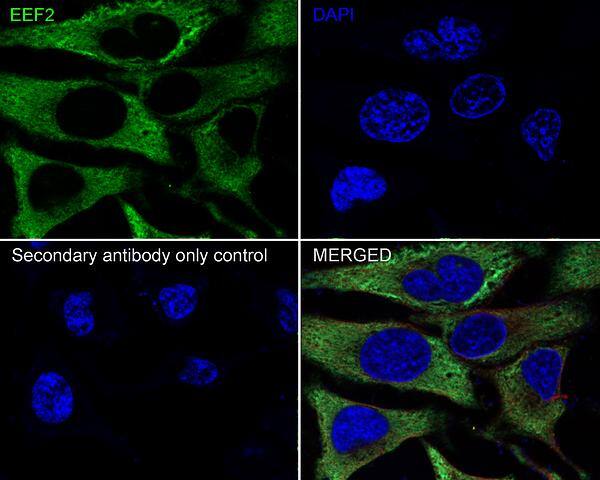 eEF-2 Antibody (JE32-57)