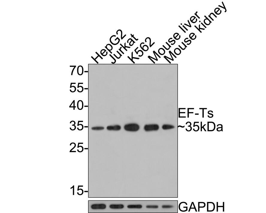 TSFM Antibody (JE64-29)