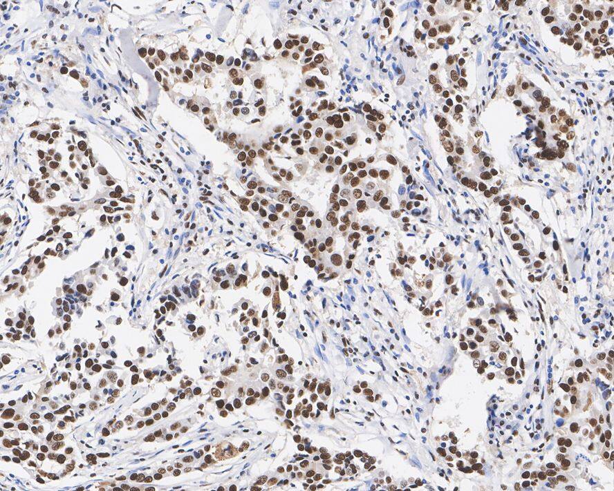 EFTUD2 Antibody (1-D10-A1-R)