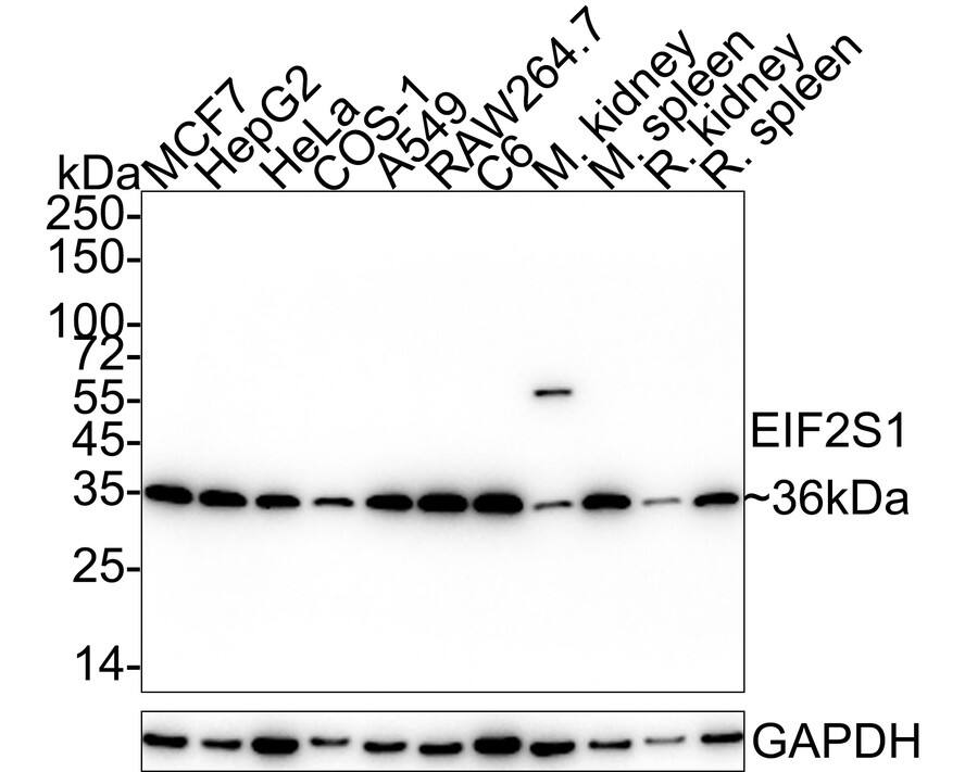 eIF2 alpha/EIF2S1 Antibody (PSH04-29)