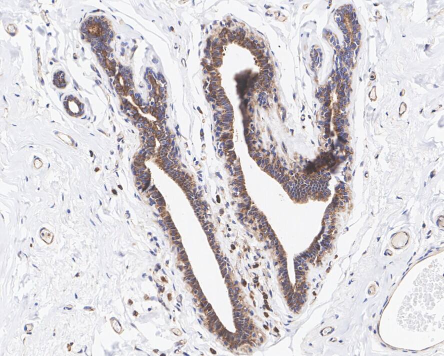 eIF2 alpha/EIF2S1 Antibody (PSH04-29)