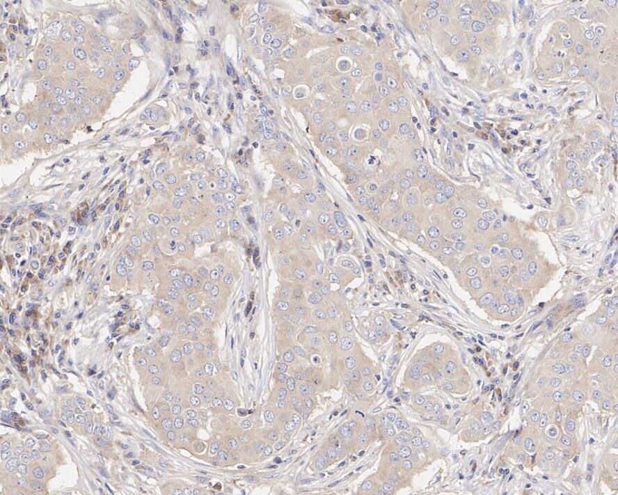 EIF3S3 Antibody (PSH04-49)