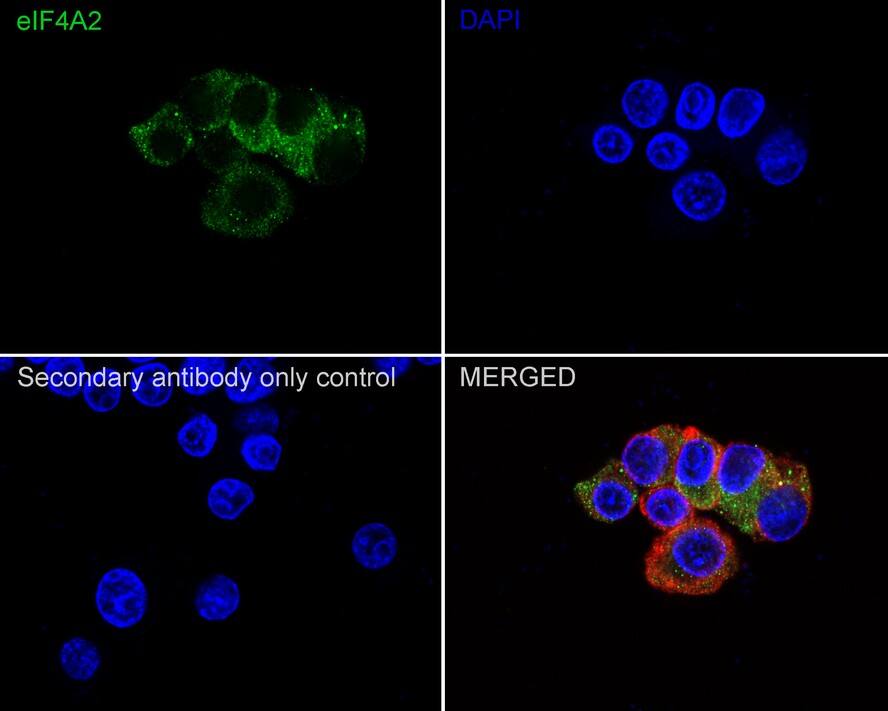 eIF4A2 Antibody (PSH01-88)