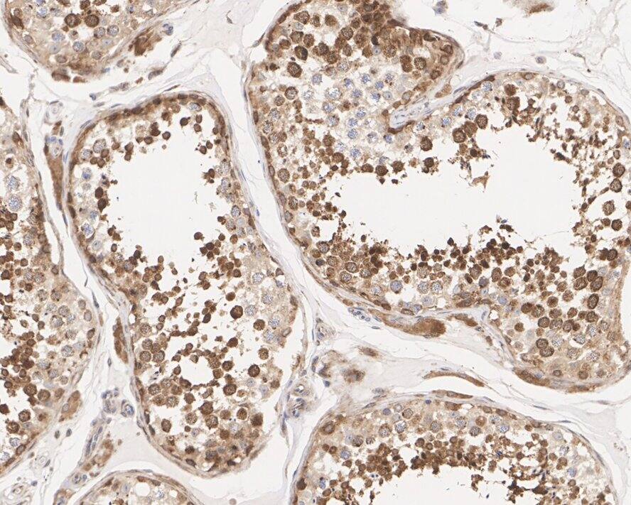 eIF4A2 Antibody (PSH01-88)