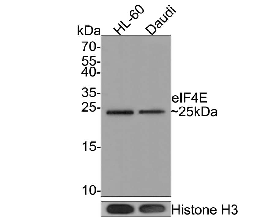 eIF4E Antibody (JE60-70)