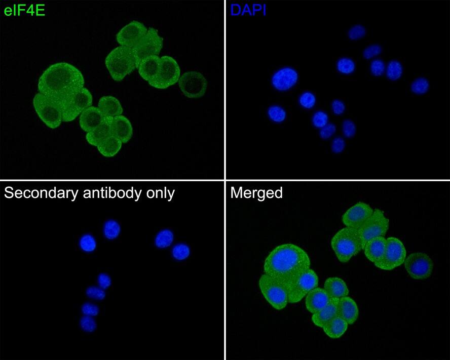 eIF4E Antibody (JE60-70)