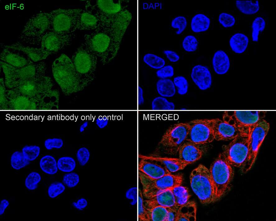 integrin beta 4 binding protein Antibody (A6A3-R)