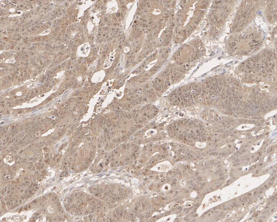 integrin beta 4 binding protein Antibody (A6A3-R)