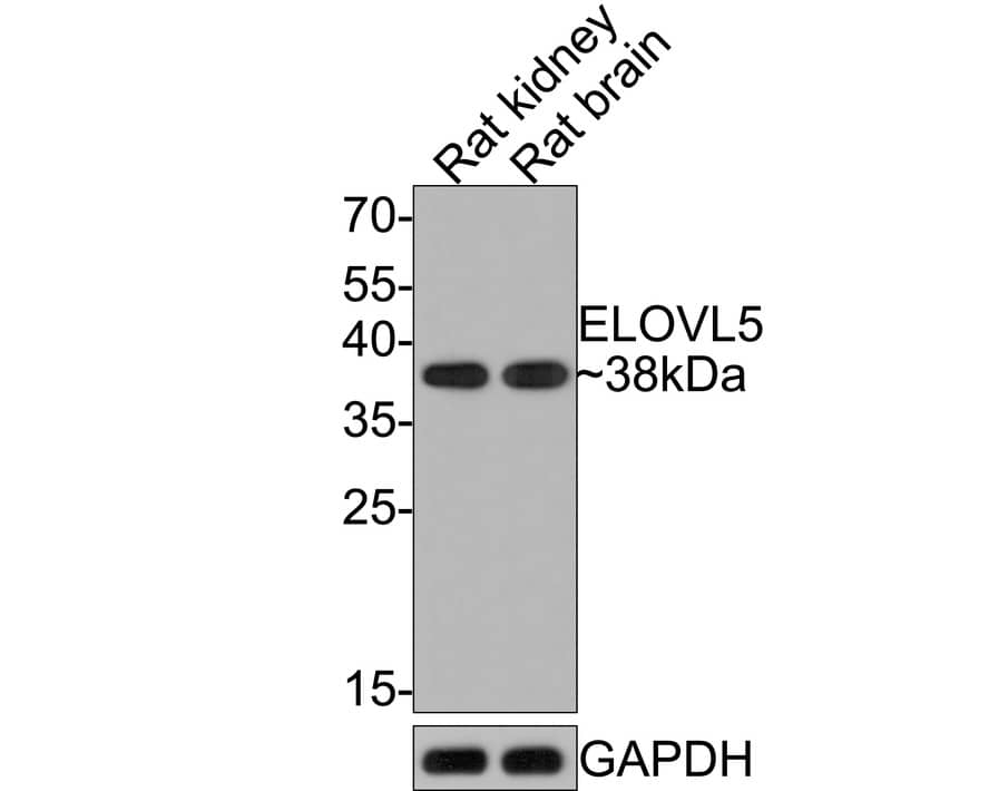 ELOVL5 Antibody (JE65-70)