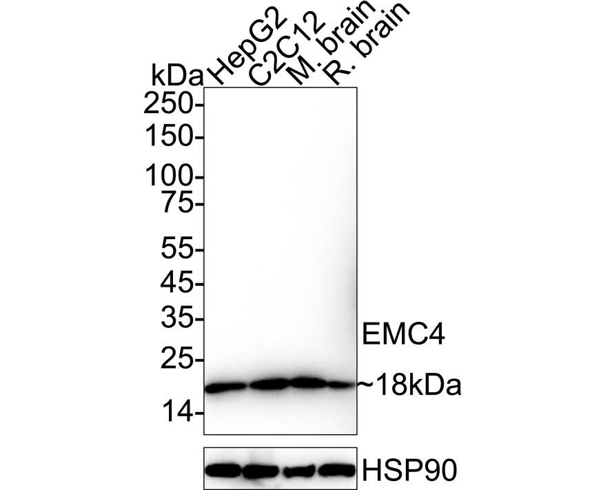 TMEM85 Antibody (JE65-17) Western Blot: TMEM85 Antibody (JE65-17) [NBP3-32306]