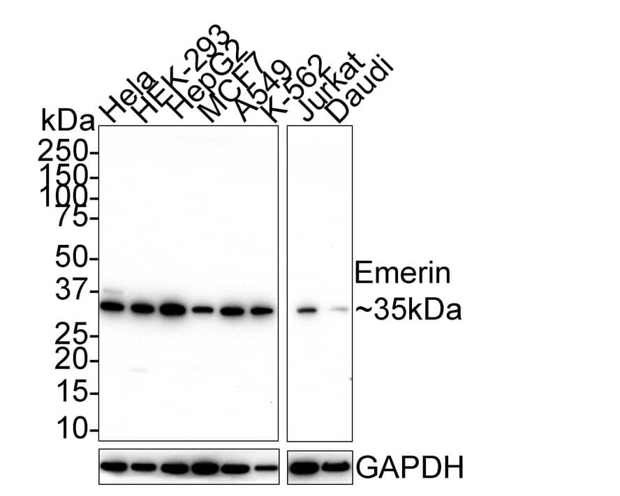 Emerin Antibody (PSH01-85)