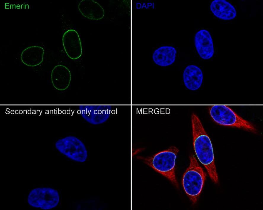 Emerin Antibody (PSH01-85)