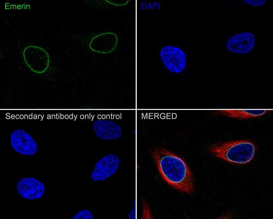 Emerin Antibody (PSH01-86)