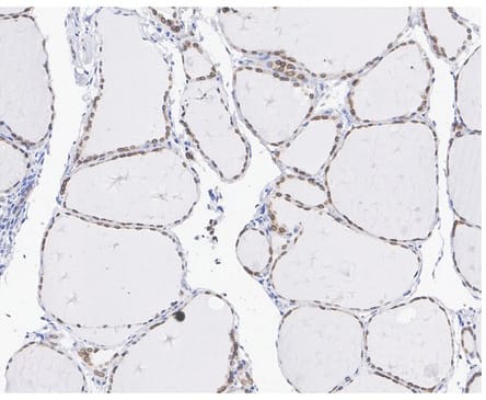 Emerin Antibody (PSH01-86)