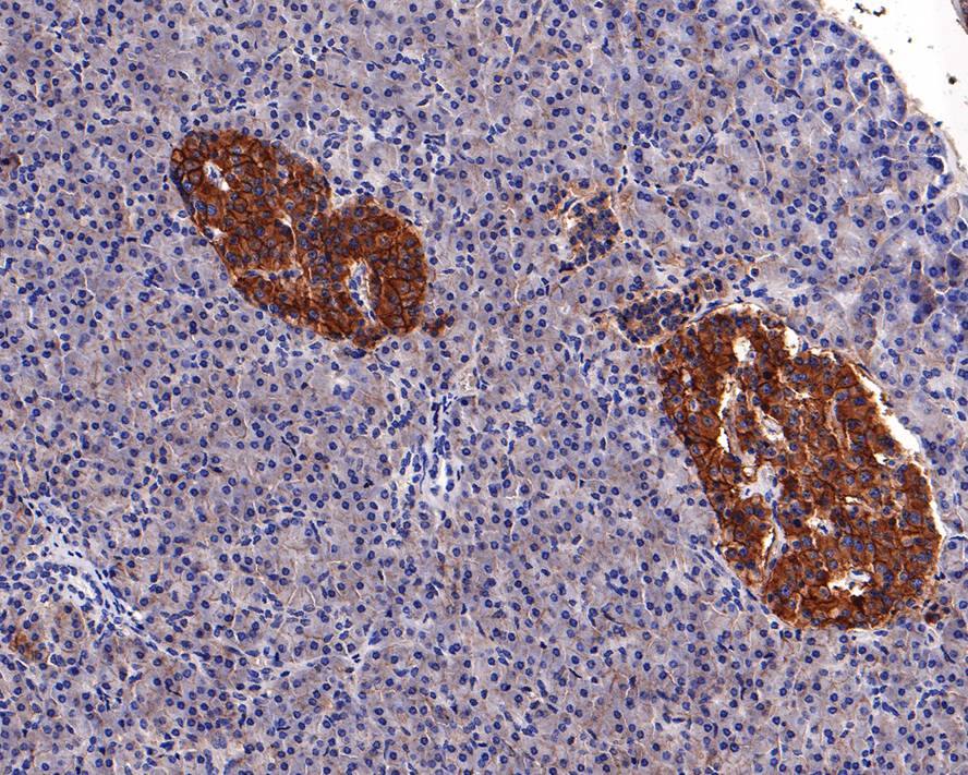 ENT1 Antibody (PD00-77)