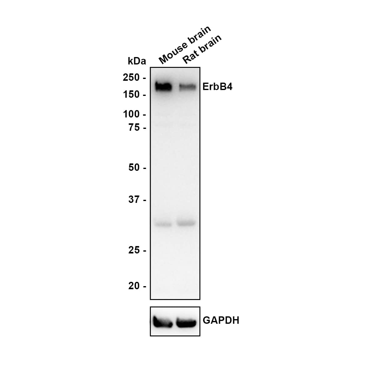 ErbB4/Her4 Antibody (JE59-43) Western Blot: ErbB4/Her4 Antibody (JE59-43) [NBP3-32314]