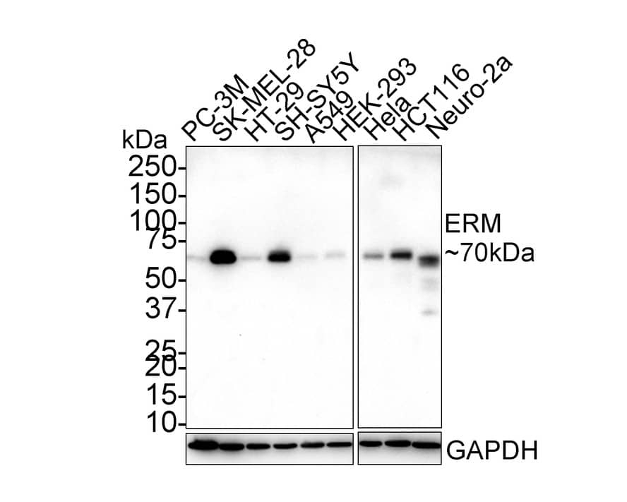 ETV5/ERM Antibody (PSH02-64)