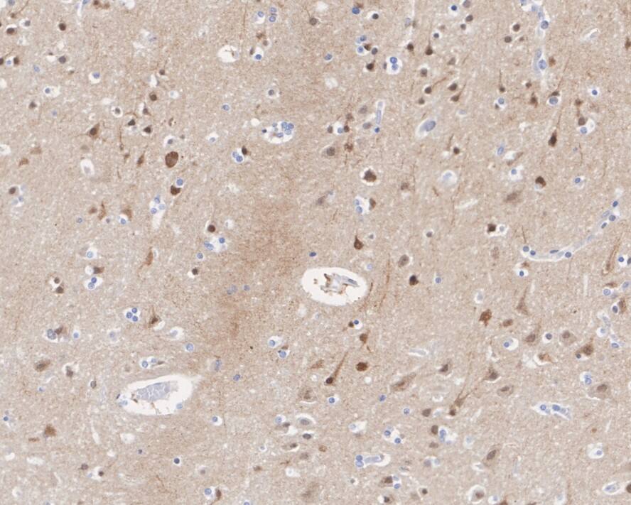 ETV5/ERM Antibody (PSH02-64)