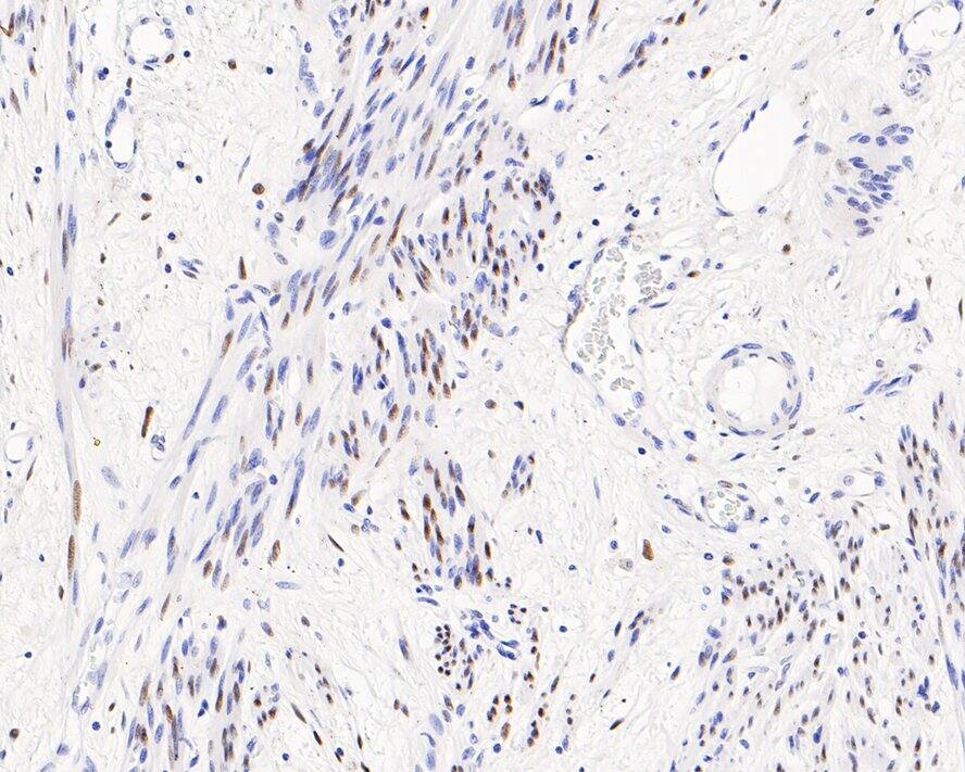 ER alpha/NR3A1 Antibody (PD00-04)