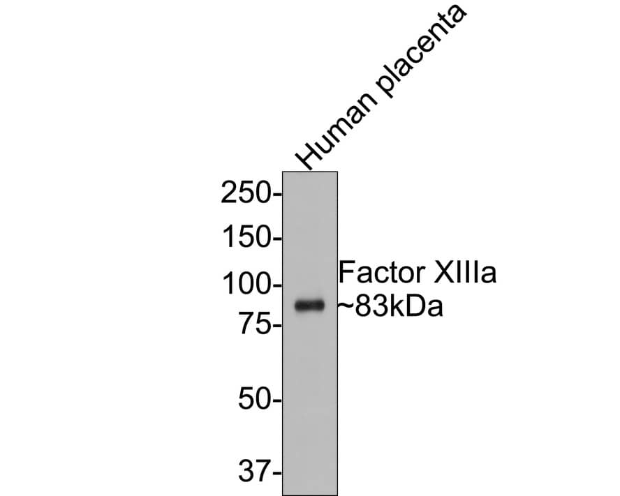 Factor XIIIa Antibody (PD00-08)