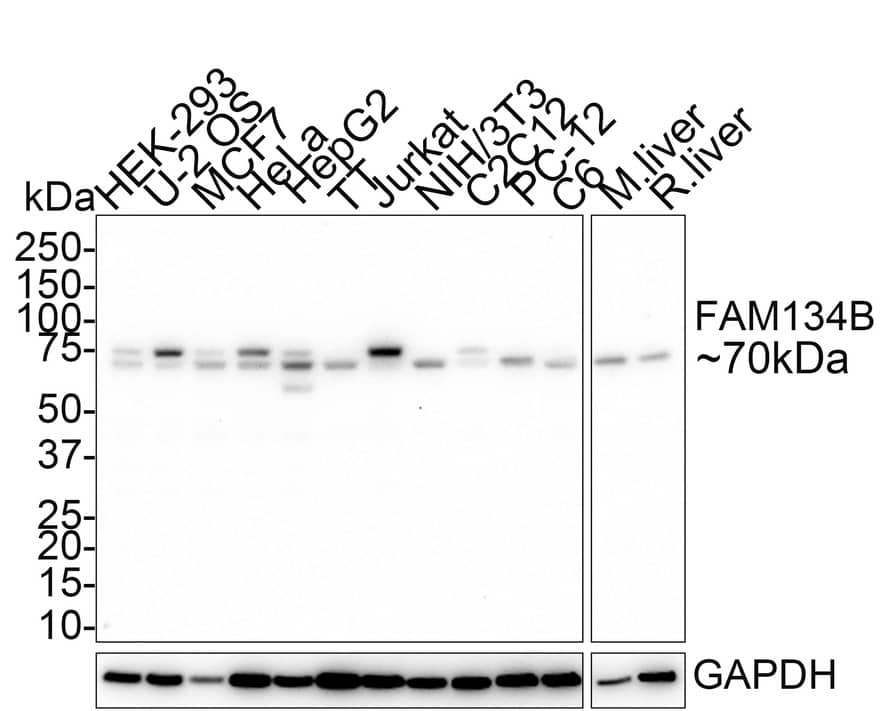 FAM134B Antibody (PSH01-94)