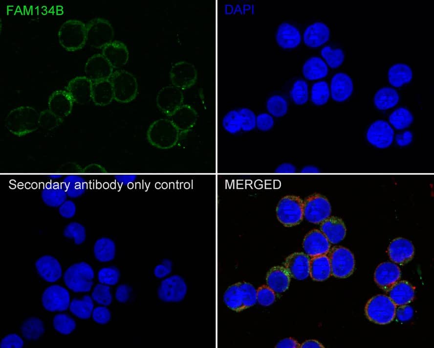 FAM134B Antibody (PSH01-94)