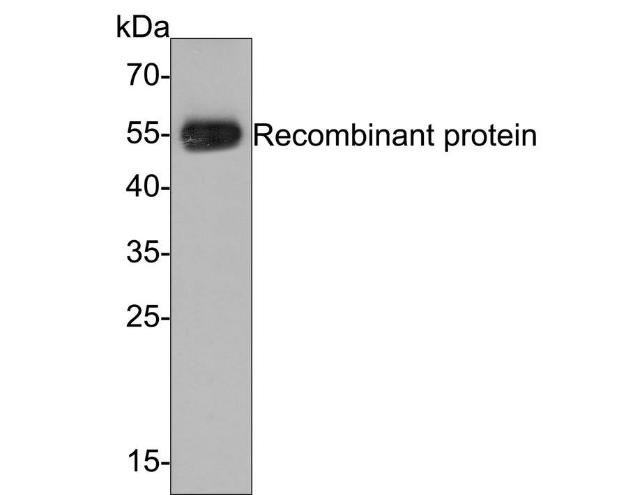 PIEZO1 Antibody (2-10-R-A)