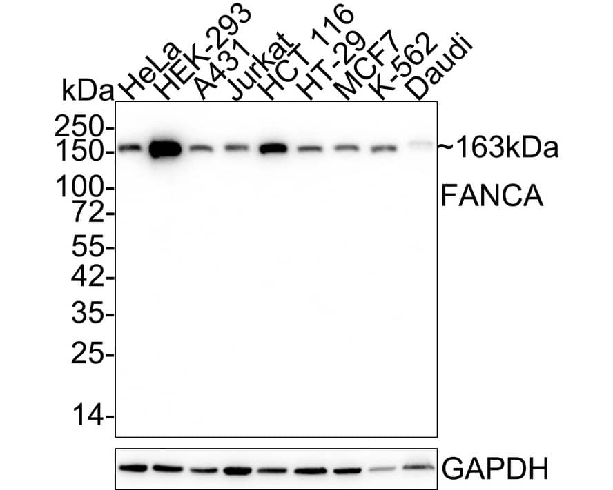 FACA/FANCA Antibody (JE36-22)