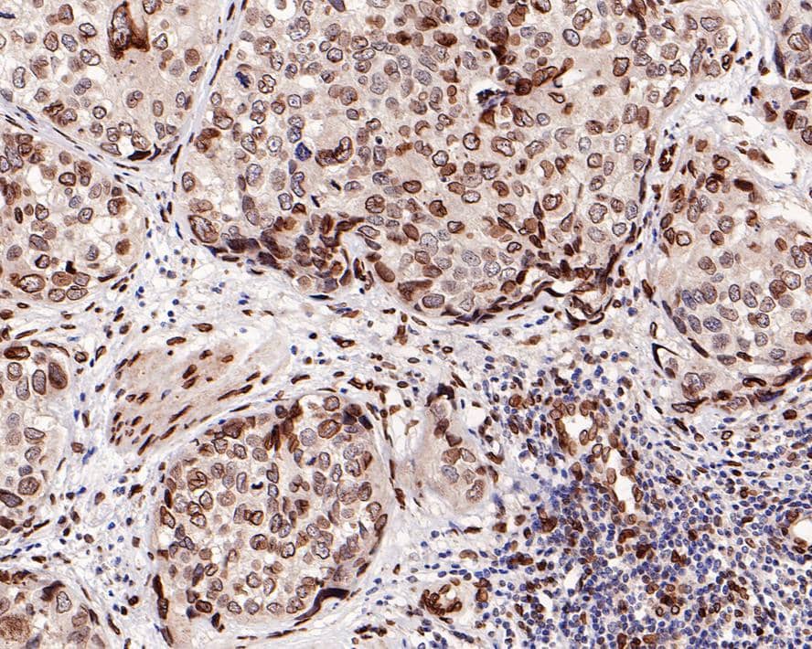 FBXW7/Cdc4 Antibody (PD00-51)