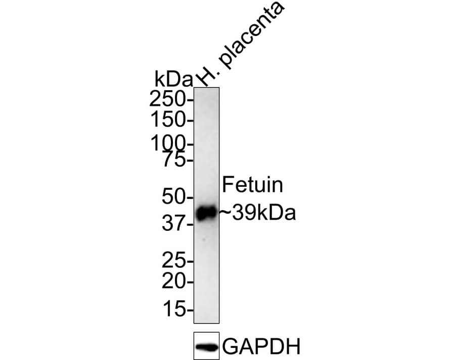 Fetuin A/AHSG Antibody (JE54-96)